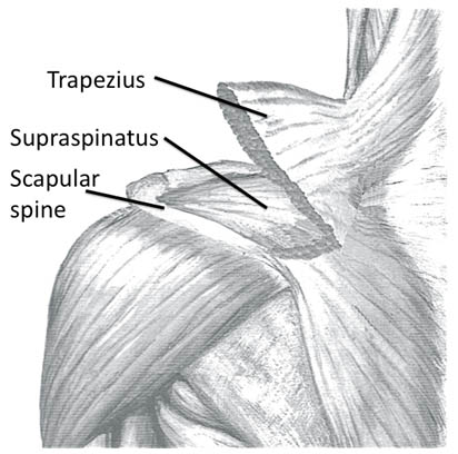 suprascapular-nerve-block-left-shoulder